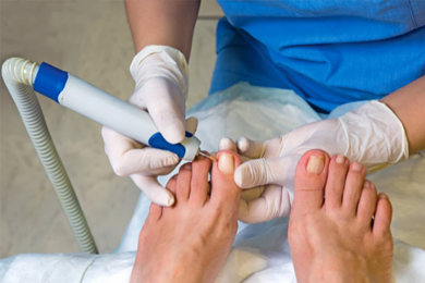 Nail Treatment Services in Hyderabad