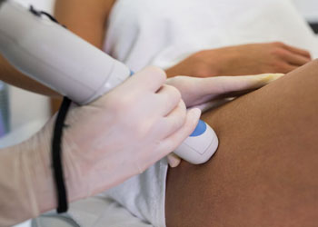 Stretch Marks Treatment Clinic In Kothapet